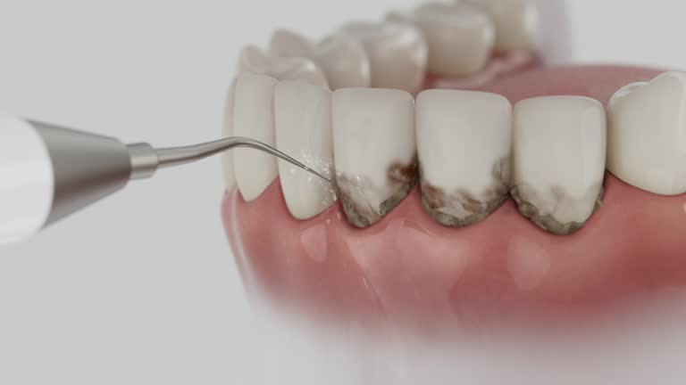 Trusted Tooth Extraction service in Brandon, MS - Dentist Open Now
